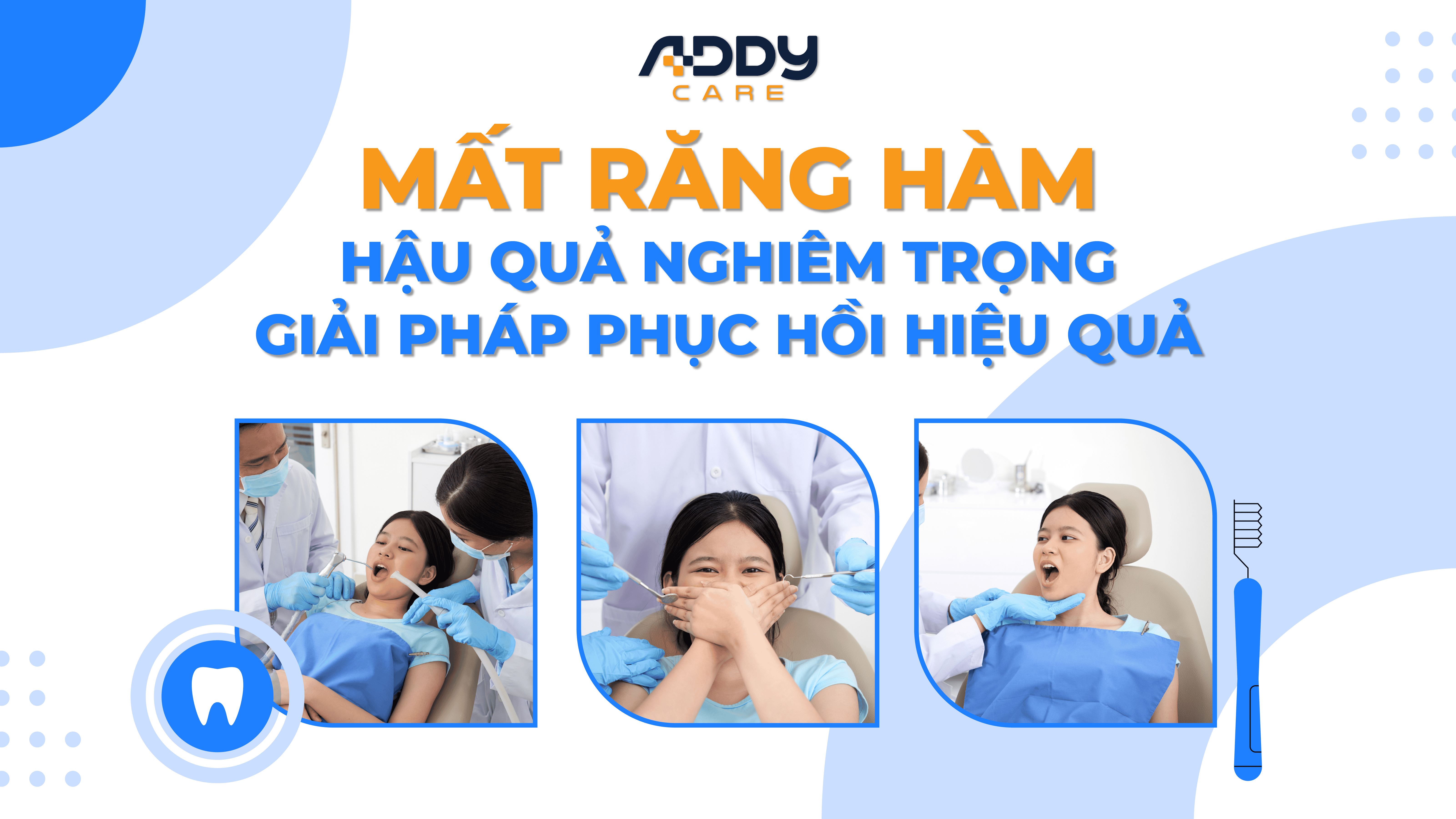 Mất răng hàm mặt: Hậu quả nghiêm trọng và giải pháp phục hồi hiệu quả